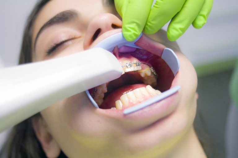 Co jest ważne w przypadku leczenia ortodontycznego?